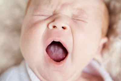 Мозоль на губі у новонародженого - причини і лікування