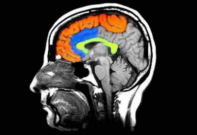 МРТ головного мозку з контрастом, що показує, в чому різниця