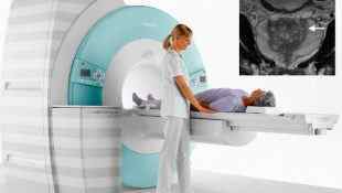 МРТ простати: показання, підготовка і проведення