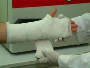 Набряк при переломі руки: причини і методи усунення