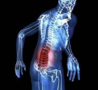 Набряк спинного мозку хребта, наслідки та лікування