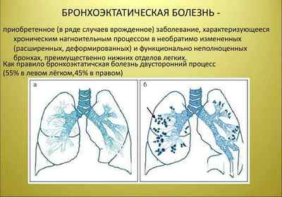 Нагноїтельниє захворювання легень, їх особливості та лікування