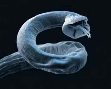 Наслідки глистів у людини: як паразити впливають на організм?