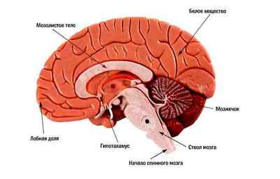 Наслідки інсульту мозочка головного мозку для людини