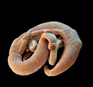 Найдешевші небезпечні паразити для людини: список найстрашніших червяків