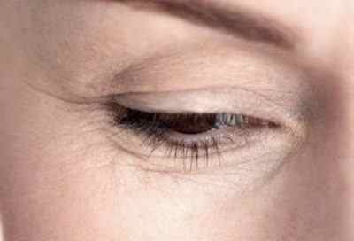Найефективніші способи для того, щоб позбутися від зморшок під очима після 30 в домашніх умовах