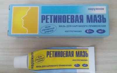 Найефективніші засоби від зморшок навколо очей: переваги, недоліки та правила застосування