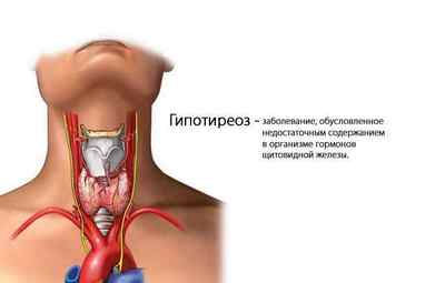 Небезпека нестачі гормонів щитовидної залози