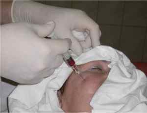 Невралгія лицьового нерва: причини, симптоми, лікування