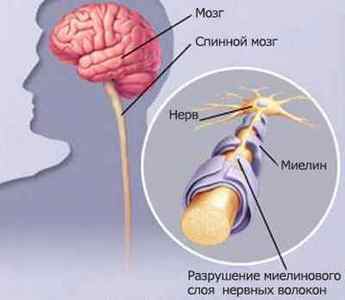 Неврит трійчастого нерва: симптоми і лікування