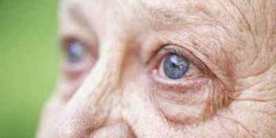 Незріла катаракта: лікування вікової (старечої) патології, причини, симптоми