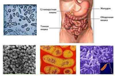 Інфекційні захворювання кишечника: симптоми і список захворювань