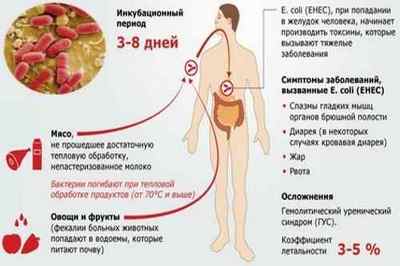 Інфекційні захворювання кишечника: симптоми і список захворювань