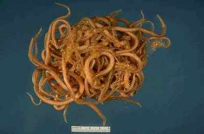 Інгерлейб: позбавлення від паразитів, червяків, глистів та лямблій в кишечнику і в організмі людини