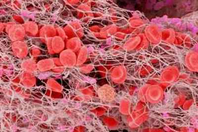 Норма тромбоцитів в крові у чоловіків за віком (таблиця)