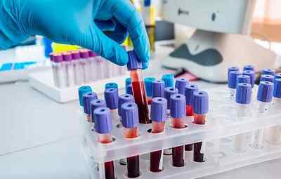 Нормальні показники біохімічного аналізу крові людини