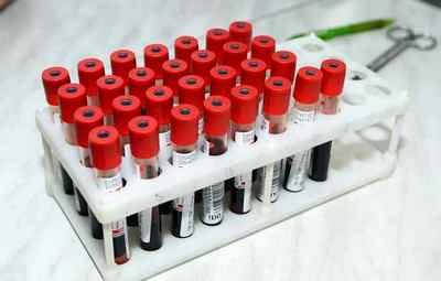 Норми біохімічного аналізу крові жінок в таблицях