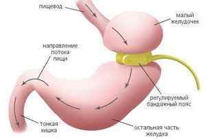 Обсяг шлунка: яких розмірів орган у дитини і дорослих, способи зменшити