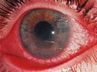 Очі-хамелеони у людини: чому вони можуть змінювати колір, їх значення, як називаються