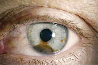 Очі-хамелеони у людини: чому вони можуть змінювати колір, їх значення, як називаються