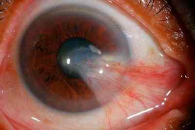 Очні краплі Актипол: інструкція із застосування для очей, відгуки