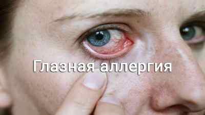 Очні краплі Деринат: інструкція із застосування, чи можна капати очі при конюнктивіті