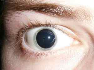 Очні краплі для розширення зіниць (судинозвужувальні): час дії, що капають в очі