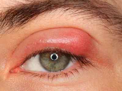 Очні краплі Левофлоксацин: інструкція із застосування для очей, аналоги