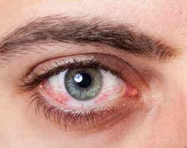 Очні краплі Офтагель: інструкція із застосування, відгуки про гелі для очей