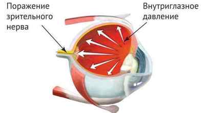 Очна мазь Гідрокортизон: інструкція із застосування і відгуки