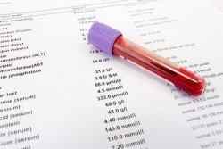 Онкомаркери кишечника: список, аналіз і його розшифровка