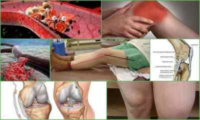 Операція на хрестоподібних звязках колінного суглоба: види, проведення, реабілітація, ціна, відгуки