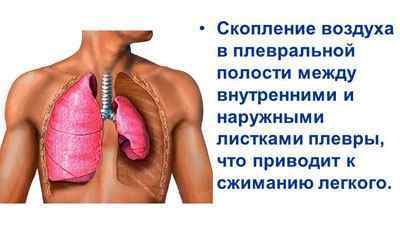 Операція на легенях при туберкульозі - хірургічне лікування