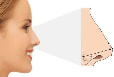 Операція на ніс: показання, протипоказання, наслідки