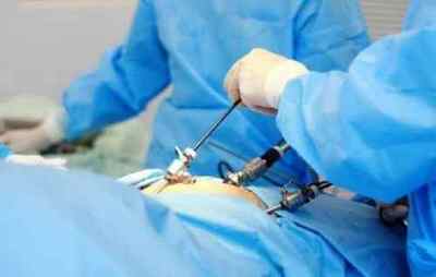 Операція при гідроцеле: види процедур, підготовка та реабілітація