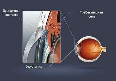 Операція при глаукомі: хірургічне лікування ока, відгуки, оперативне видалення і наслідки