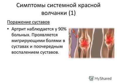 Опис операції з ендопротезування колінного суглоба