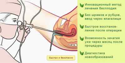 Основні показання для видалення матки при міомі (відгуки пацієнток)