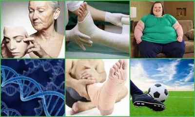 Остеоартрит суглобів: причини, симптоми, лікування, фото