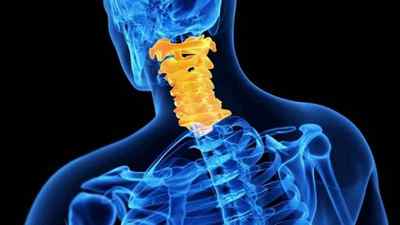Остеоартроз шийного відділу хребта: симптоми і лікування остеоартрозу унковертебральних зчленувань | Ревматолог