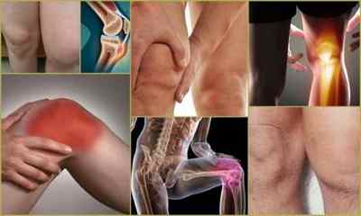 Остеохондропатия колінного суглоба у дітей: причини, симптоми, лікування