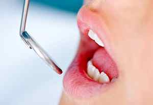 Остеомієліт зуба - симптоми і лікування