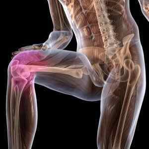 Остеопороз колінного суглоба: симптоми і лікування, як визначити, ліки Бонвіва і муміє остеопорозу, маркери остеопорозу | Ревматолог