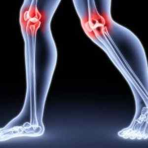 Остеотомія колінного і тазостегнового суглобів: відгуки та періацетабулярная остеотомія при дисплазії, реабілітація | Ревматолог