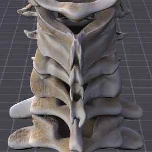Остистийвідросток шийного хребця і поперекового відділу хребта: що це таке | Ревматолог