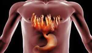 Ознаки гастриту шлунка: перші симптоми різних форм хвороби, причини