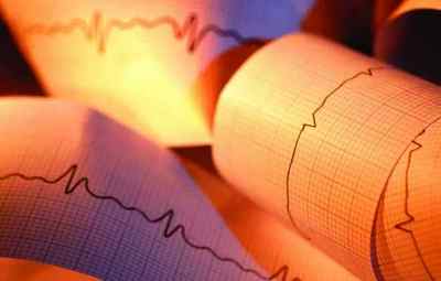 Ознаки на ЕКГ інфаркту міокарда