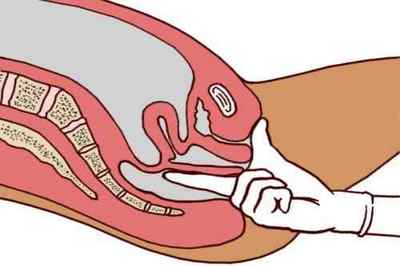 Пальцеве дослідження прямої кишки: підготовка і проведення процедури