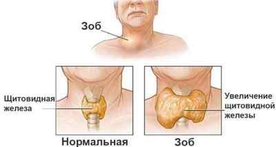 Пальпація щитовидної залози: як прищепити щитовидку