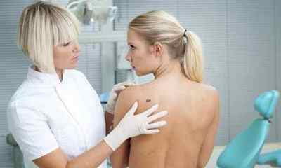 Папілома на спині: причини і способи лікування захворювання